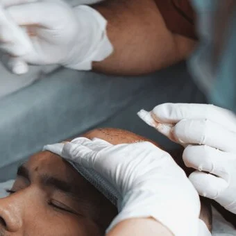 Haartransplantation MerhaBeauty Haartransplantation MerhaBeauty