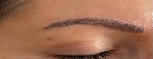 Augenbrauentransplantation vorher nachher MerhaBeauty 7 Augenbrauentransplantation vorher nachher MerhaBeauty 7