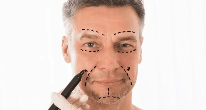 Facelifting bei MerhaBeauty in der Türkei Facelifting bei MerhaBeauty in der Türkei